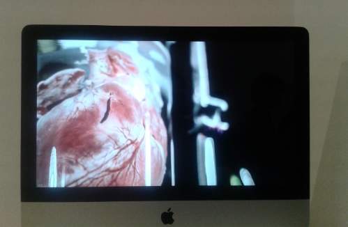 Future Human at GV Art - Decellurisation Timelapse by Jed Welland Pongthorn Future Human at GV Art - Decellurisation Timelapse by Jed Welland Pongthorn